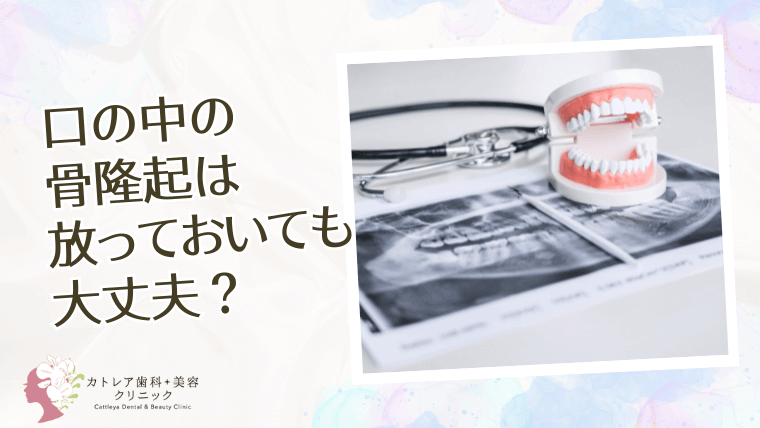 口の中の骨隆起は放っておいても大丈夫？