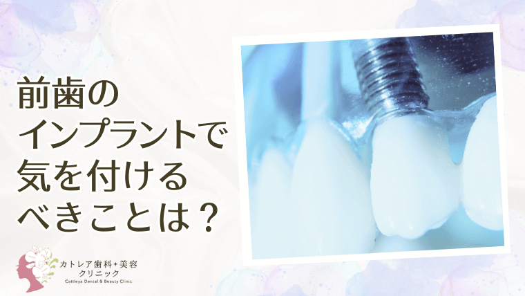 前歯のインプラントで気を付けるべきことは？