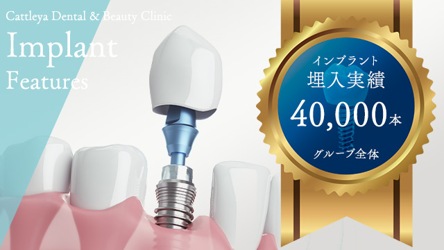 インプラント治療実績